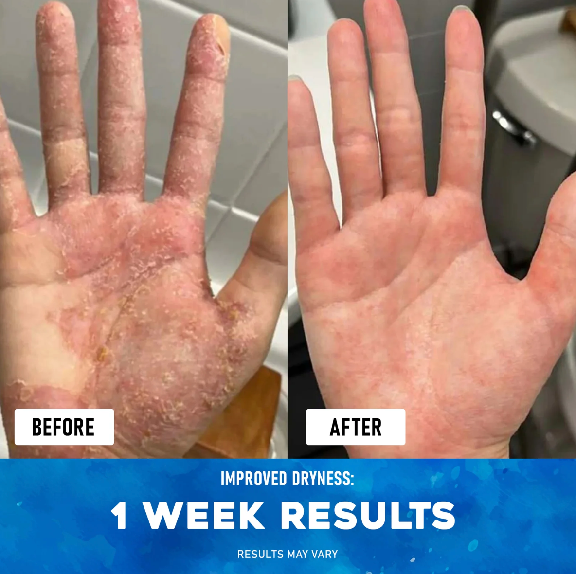 Premium Eczema Relief Cream with Sea Moss, Aloe Vera & Oats