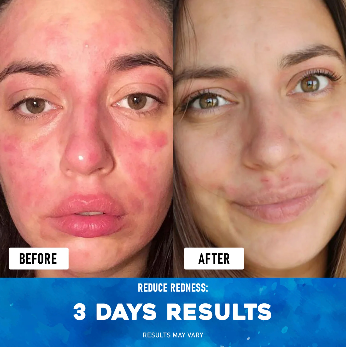 Premium Eczema Relief Cream with Sea Moss, Aloe Vera & Oats