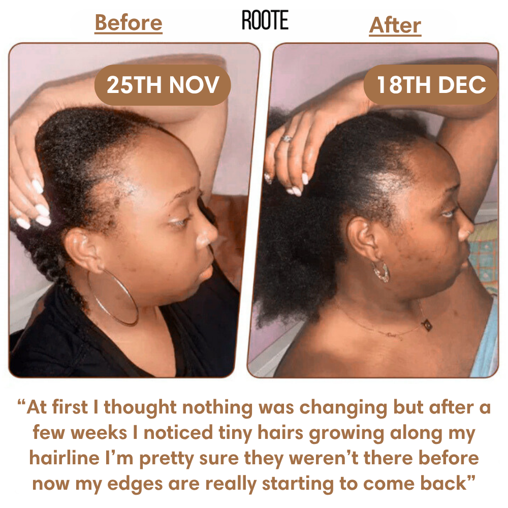 Roote™ - Batana Oil