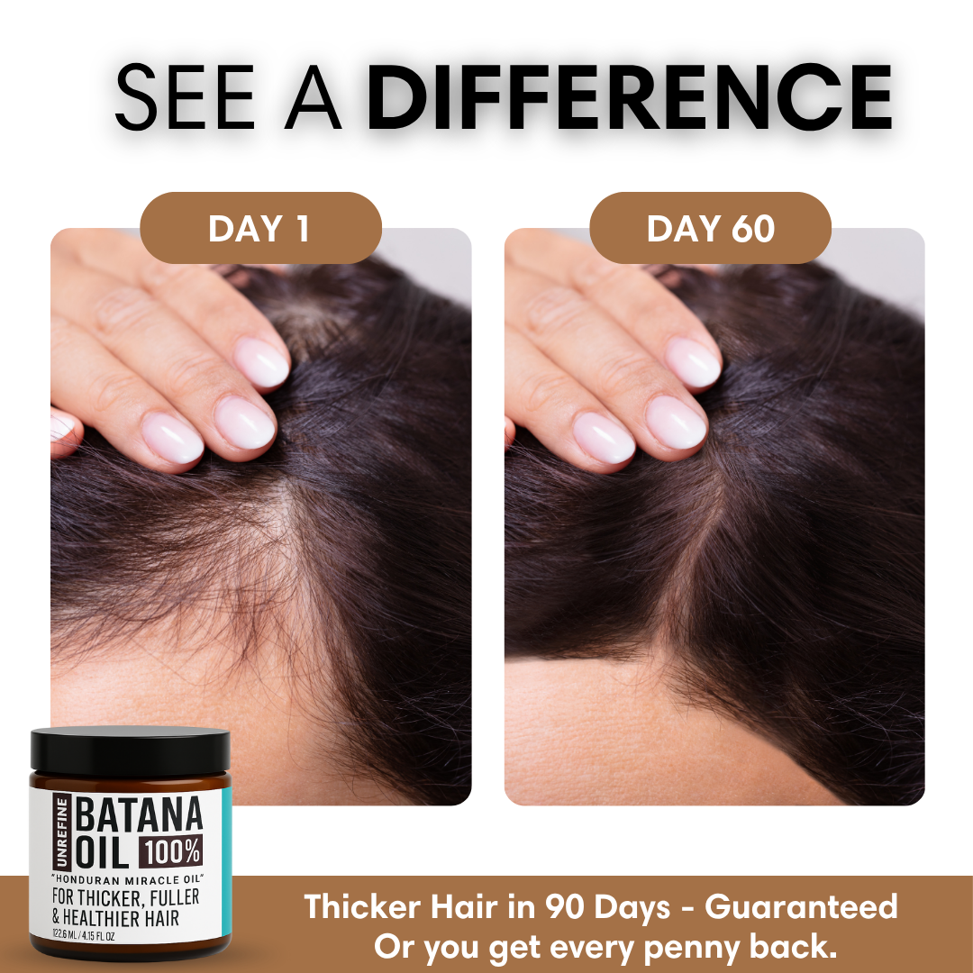 Roote™ - Batana Oil