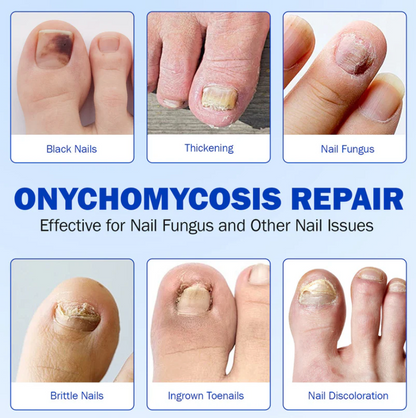 Roote  - Fungal Nail Patches
